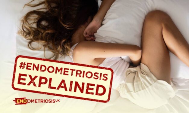 Endometriosis explained - a woman lyingo n her side, holding her stomach in pain and hiding her face in a pillow